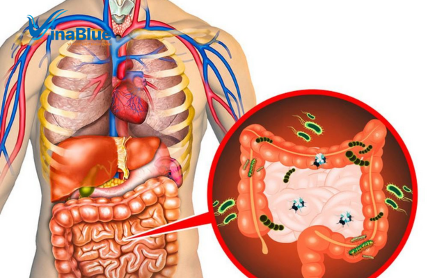 Chỉ nên áp dụng các phương pháp thải độc theo từng giai đoạn để cơ thể dần tiếp thu