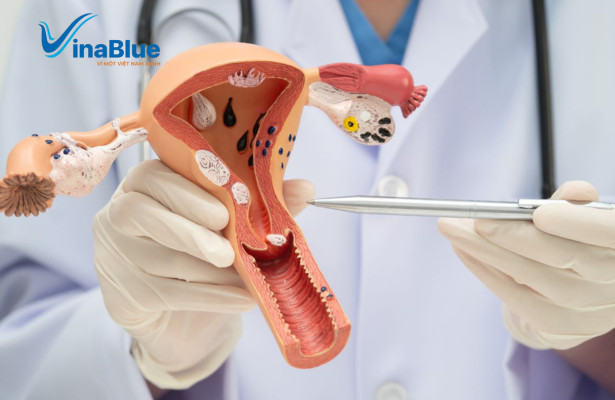 Thải độc tự nhiên tại nhà không thể thay thế các biện pháp điều trị y tế chuyên sâu dành cho cổ tử cung ở nữ giới