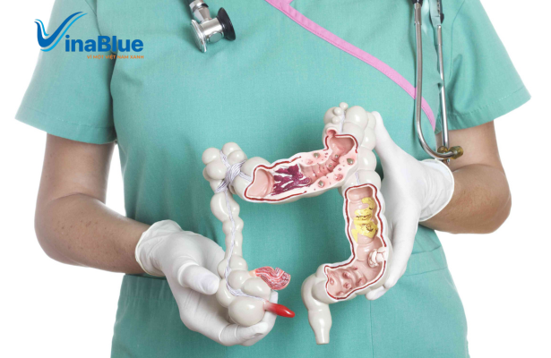 Thải độc đại tràng là nơi dễ bị tích tụ cặn bã và độc tố xuất phát từ chế độ sinh hoạt không lành mạnh kéo dài